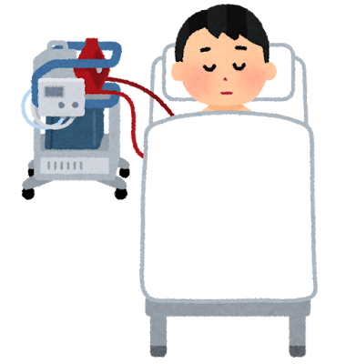 エクモってなに？？